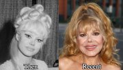 Charo-plastic-surgery.jpg