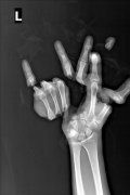 fingers.jpg